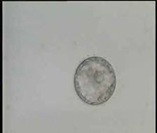 Expanding Blastocyst